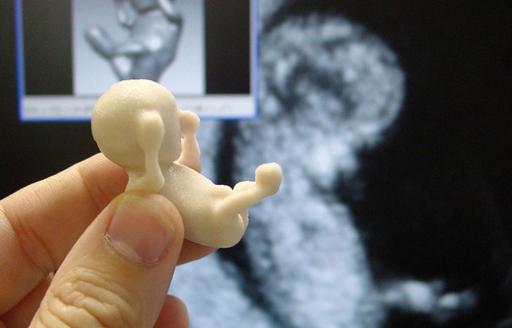 foetus dans le ventre d'un enfant